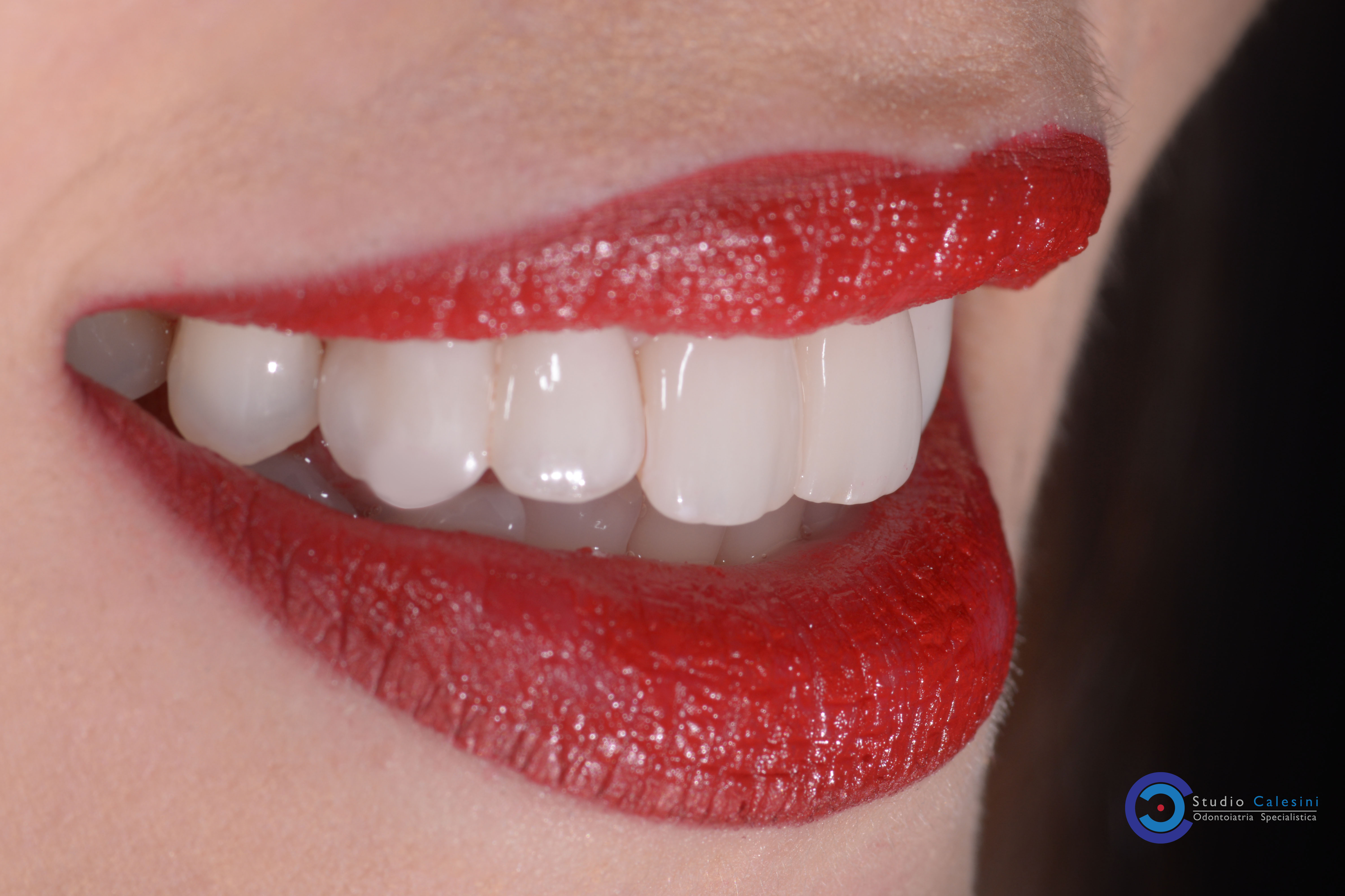 Odontoiatria Estetica: tutto quello che dovreste sapere sulla salute orale e l’estetica dentale!