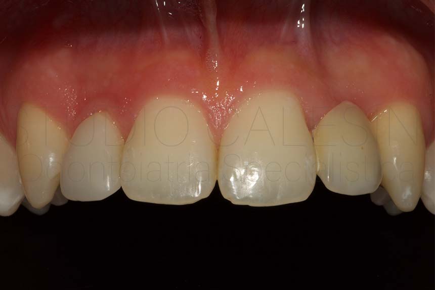 dentista centro roma Agenesie dentali, impianti dentali, ortodonzia, odontoiatria estetica, dentista roma, dentista,